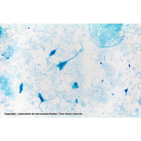 Dissociated neurons, brain smear microscope slide