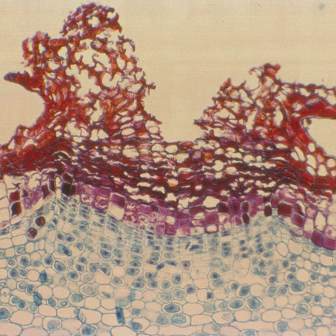 Elderberry Lenticel Sambucus Microscope Slide