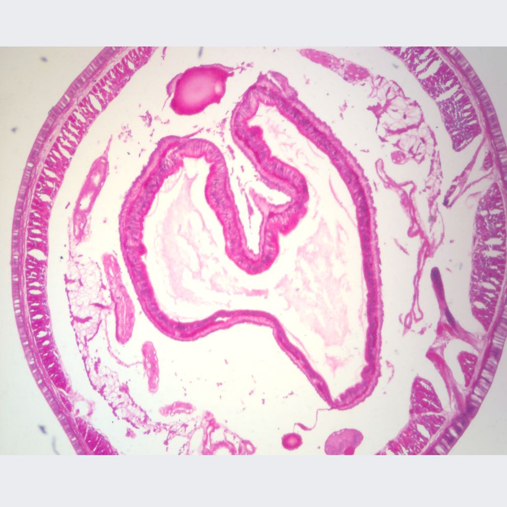 Earthworm Intestinal Region C.S Microscope Slide – SMARTQAT
