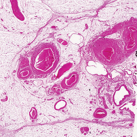 Human Artery and Vein Microscope Slides