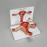 GPI Anatomicals® Human Uterus and Ovary Pathology Model (made in USA) نموذج الرحم البشري و المبيض