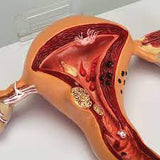 GPI Anatomicals® Human Uterus and Ovary Pathology Model (made in USA) نموذج الرحم البشري و المبيض