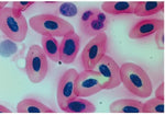 Nucleated red blood cells, smear 575023 شرائح خلايا دم حمراء