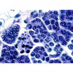 Meiosis, testicle, locust, all stages خلايا من خصية الجراد 575140