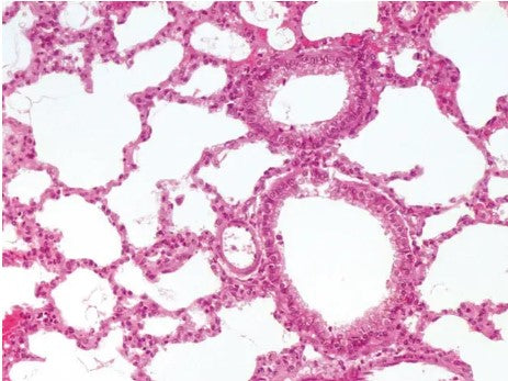 Lung, mammal, alveoli 575423 شرائح الحويصلات الهوائية