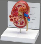 Kidney disease model نموذج الكلية