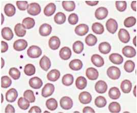 Red Blood Cell Slide Hover