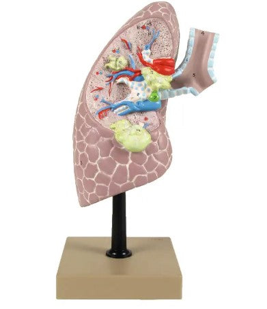 MODEL OF CANCER LUNG 512130