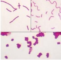 Bacterial Types (Bacillus, Coccus, and Spirillum) Microscope Slide